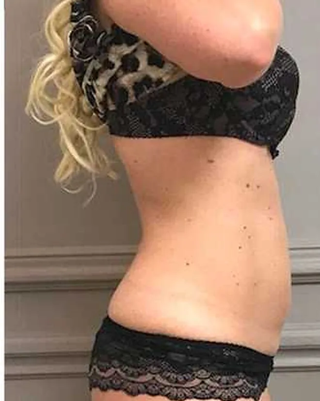 After four sessions, month 3