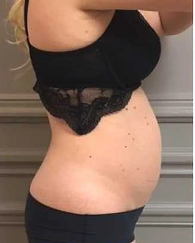 Before treatment, day 0